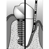 Advanced Periodontics gallery