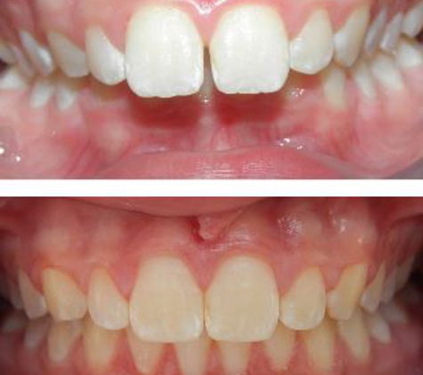 Glenn Carty Orthodontist - Gungahlin, ACT