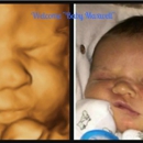 O Baby! 4D Live Ultrasound Studio - Medical Imaging Services