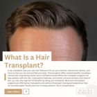 Arocha Hair Restoration