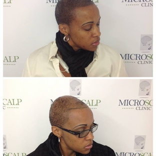 MicroScalp Clinic - Fairhaven, MA