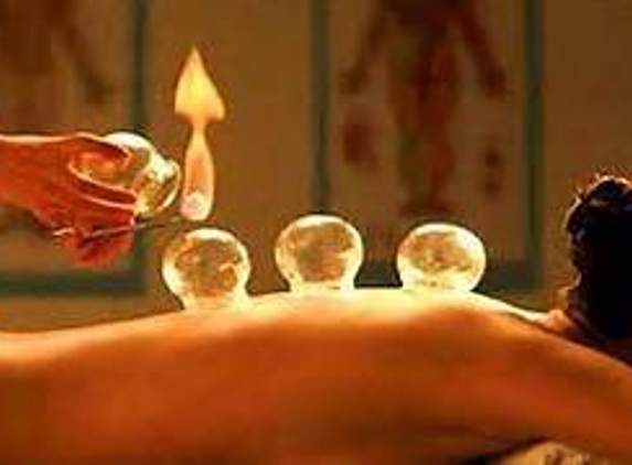 Huntsville Wellness: Acupuncture & Naturopathy - Huntsville, AL. Dr. Mick uses fire cupping in my acupuncture treatment to help relieve my fibromyalgia pain and keep it from coming back