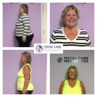 Total Care Weight Loss