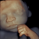 Prenatal Universe Ultrasound - Medical Imaging Services