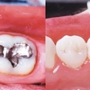 Northpointe Smiles gallery