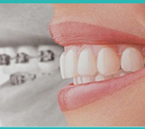 Quality Orthodontic Care - Alpharetta, GA