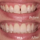 Hermosa Dental & Orthodontics - Dentists