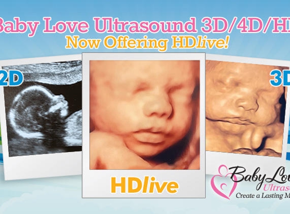 Baby Love Ultrasound - League City, TX