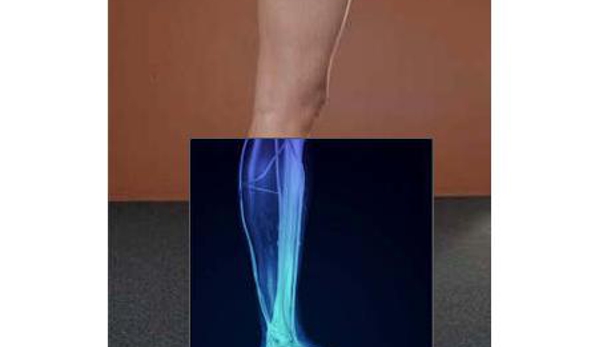 Footsmart Podiatry - Maroochydore, QLD
