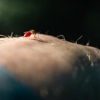 Bonaire Pest Services gallery