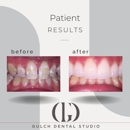 Gulch Dental Studio - Cosmetic Dentistry