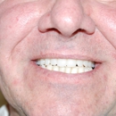 Chips Dental Associates LLC - Dentists