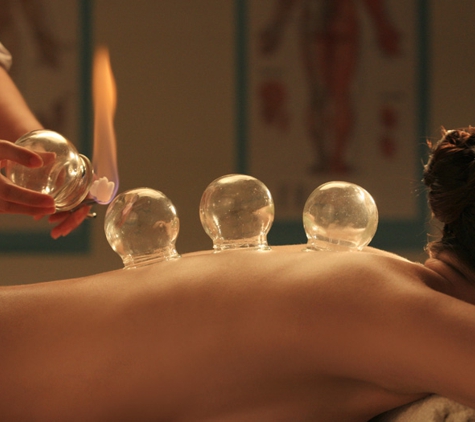 Four Seasons Acupuncture - Sun City, AZ. Cupping