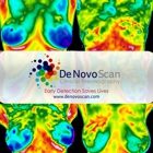 De Novo Scan, Clinical Thermography