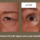 Klapper Eyelid & Facial - Physicians & Surgeons, Plastic & Reconstructive