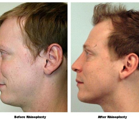 Houston Plastic Craniofacial & Sinus Surgery - Houston, TX