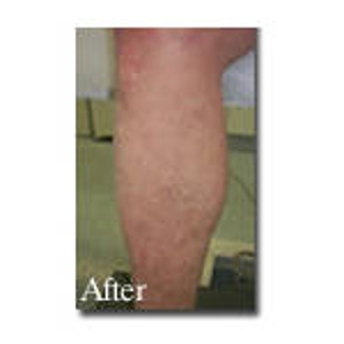 Vein Health Medical Clinic - Melbourne, VIC