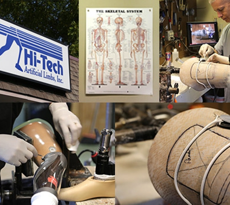 Hi-Tech Artificial Limbs - Lexington, KY