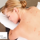 Professional Acupuncture - Physicians & Surgeons, Acupuncture