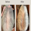 Root Revival Hair Restoration gallery