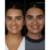 Modern Smile Design gallery