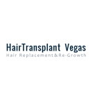 Hair Transplant Vegas