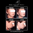 Asaadi Plastic Surgery