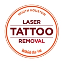 North Houston Laser Tattoo Removal - Tattoo Removal
