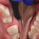 Chad Latino, DDS - Implant Dentistry