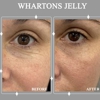 Body Sculpt Skin Laser gallery