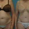 Lowe Plastic Surgery gallery