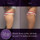 Reve - Weight Control Services