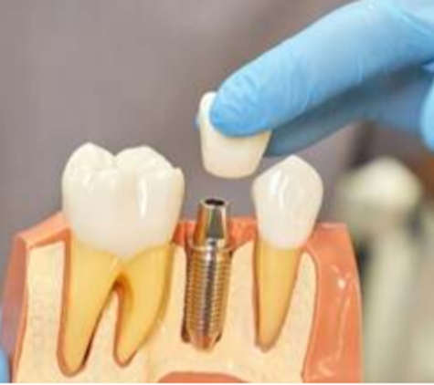 Vue Dental - Campbelltown, NSW