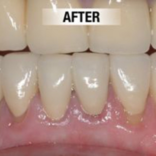 Forrest Avenue Dental Centre - South Bunbury, WA