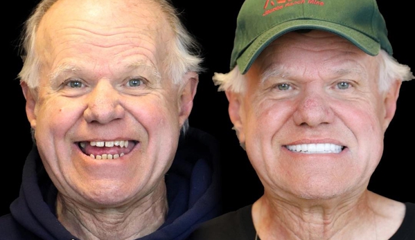 Smile Now Denver Dentures and Implants - Westminster, CO