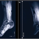 Midwest Open MRI & Imaging-Darien - MRI (Magnetic Resonance Imaging)