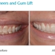 Cosmetic Dentistry of Atlanta