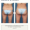 Plastic Surgery Associates gallery
