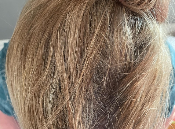 WishLane Aesthetics - Neenah, WI. You can't see my bald spot anymore, woohoo! ����