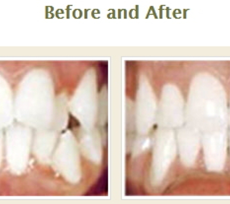 StarBrite Dental - Dublin - Dublin, CA