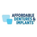 Dentures + Implants - Implant Dentistry