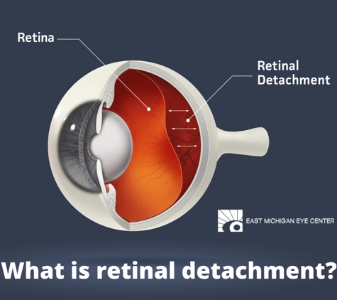 East Michigan Eye Center - Flint, MI