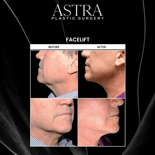 Astra Plastic Surgery - Marietta - Marietta, GA