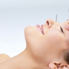 New York Traditional Acupuncture gallery