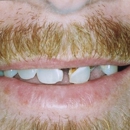 Dyersburg Dental Associates - Implant Dentistry