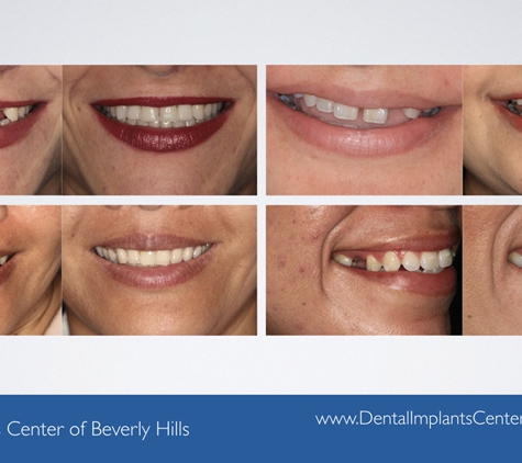 Synergy Dental Implant and Oral Surgery Center - Beverly Hills - Beverly Hills, CA