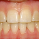 Dupont Orthodontics: Dr. Allison S. Bergdoll, DDS, MS - Dentists