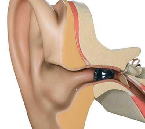 Hearing Aid Specialists Sth East Qld - Rochedale South, QLD