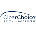 Clearchoice Dental Implants