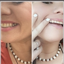 Unforgettable Smiles- Dr. John Moreau, DDS & Dr. Jade Moreau, DDS - Dental Hygienists